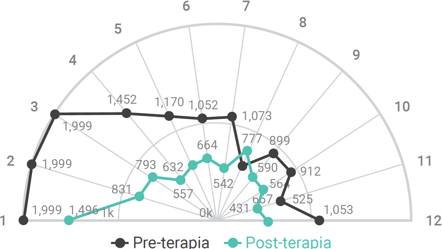 Grafico del tempo medio di risposta nei 12 settori del campo visivo, prima e dopo 20 ore di trattamento con AvDesk in un caso di emianopsia omonima sinistra: riduzione media del 36%.