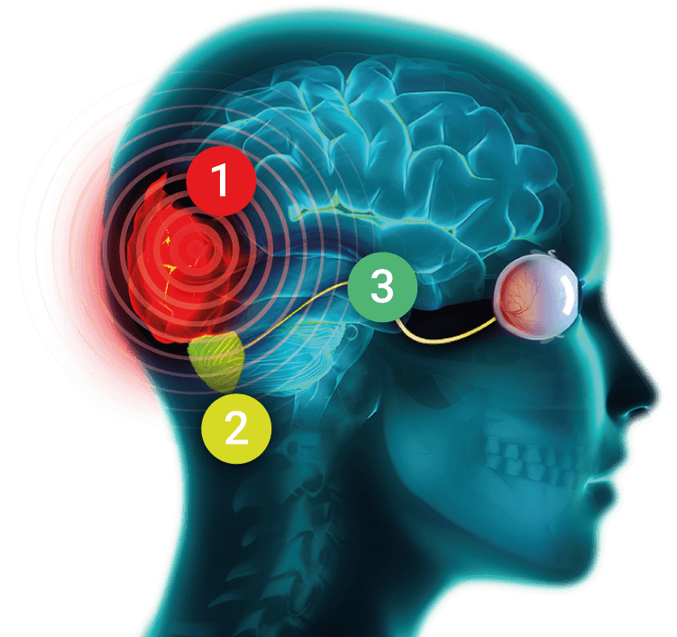 Illustrazione delle vie visive coinvolte nella stimolazione multisensoriale